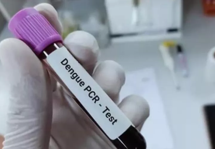 El dengue continúa siendo el principal foco de atención, con 1,670 casos acumulados, de los cuales 1,466 son sin signos de alarma.