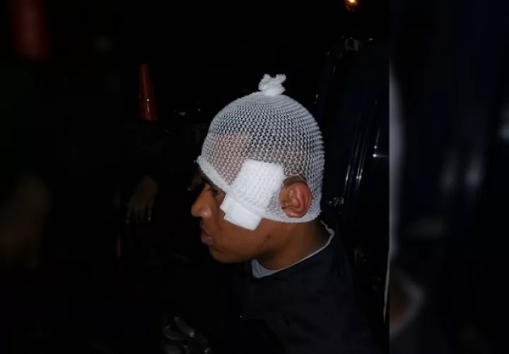 La bala le abrió una brecha en la sien.  /  Foto: chiriquinoticiaa
