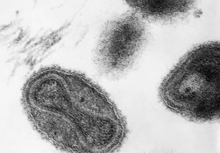 De todas las enfermedades traídas por los colonos, la viruela —causada por el virus Variola major— fue la más impactante. Foto: CDC/ Dr. Fred Murphy; Sylvia Whitfield