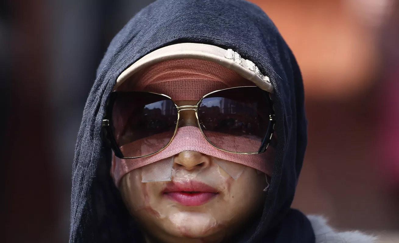 Galería de fotos 08/03/2015