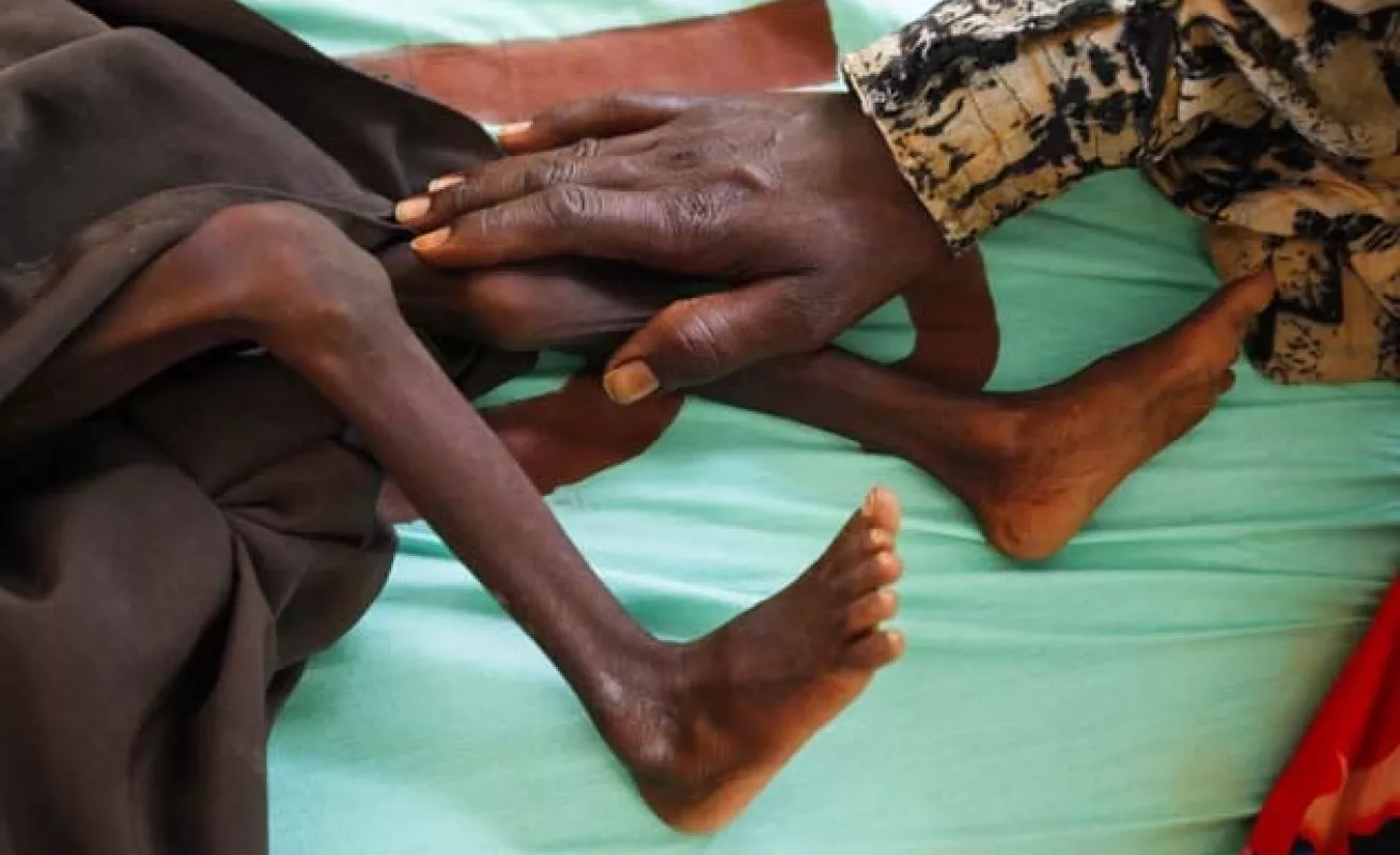 África: Hambruna, miseria, pobreza y enfermedad 