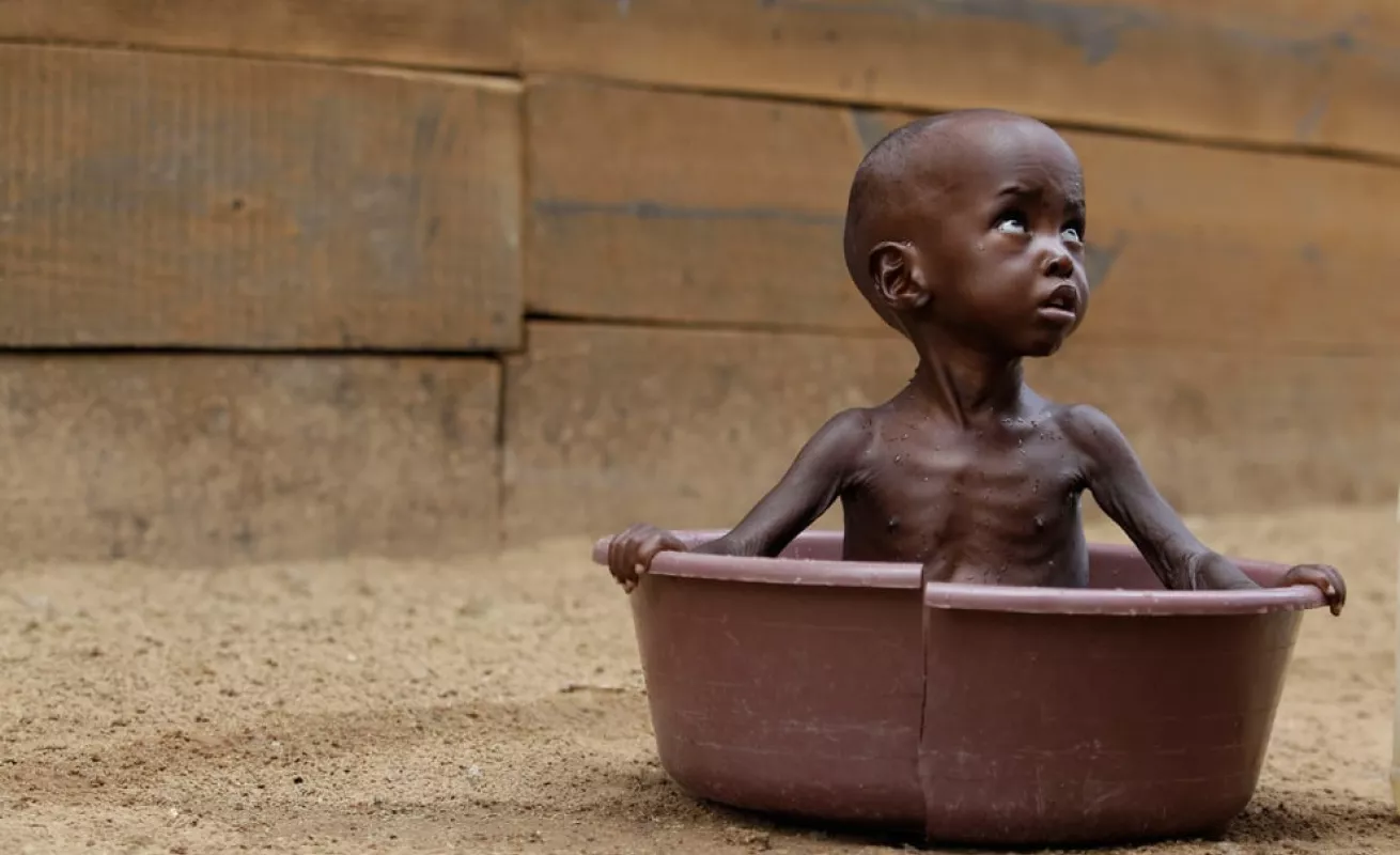 África: Hambruna, miseria, pobreza y enfermedad 