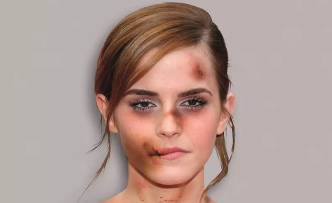 Palombo: Día Internacional de la Eliminación de la Violencia de Género