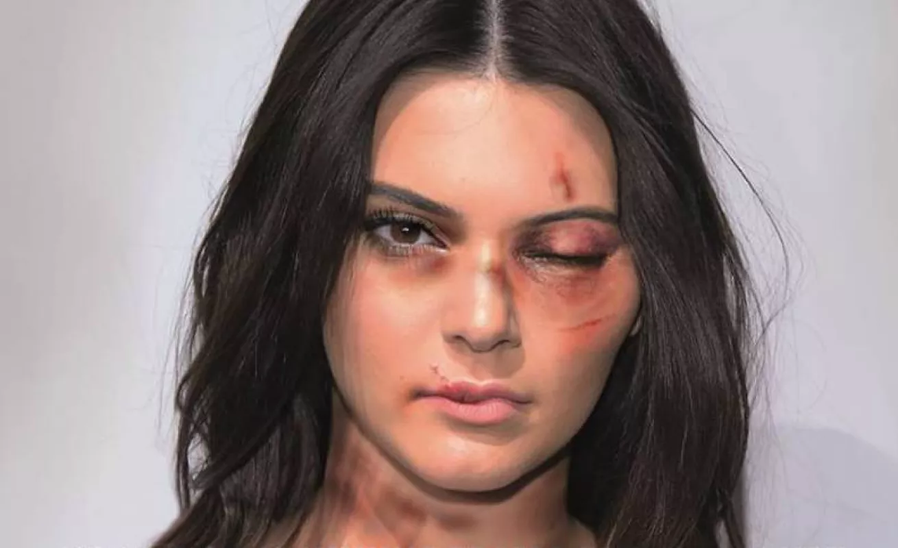 Palombo: Día Internacional de la Eliminación de la Violencia de Género