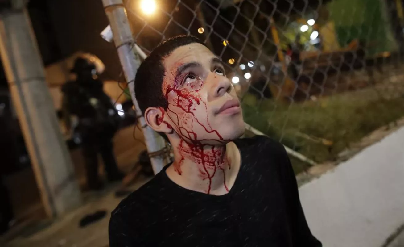 Tiradera de piedras, botellas y fuegos pirotécnicos en protestas contra reformas constitucionales