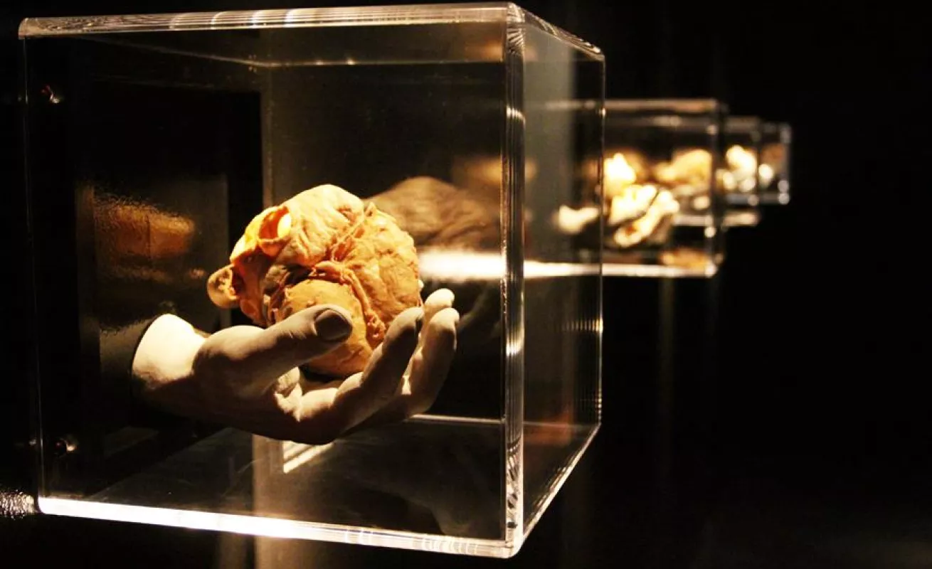 "Bodies", la exhibición de cuerpos humanos ahora expone los efectos del COVID-19 (Fotos)