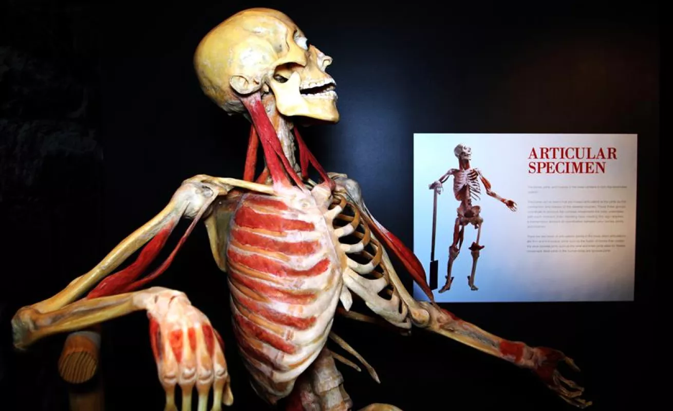"Bodies", la exhibición de cuerpos humanos ahora expone los efectos del COVID-19 (Fotos)
