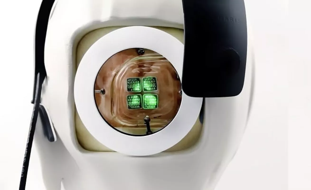 Crean el primer dispositivo para recuperar la visión (Fotos)