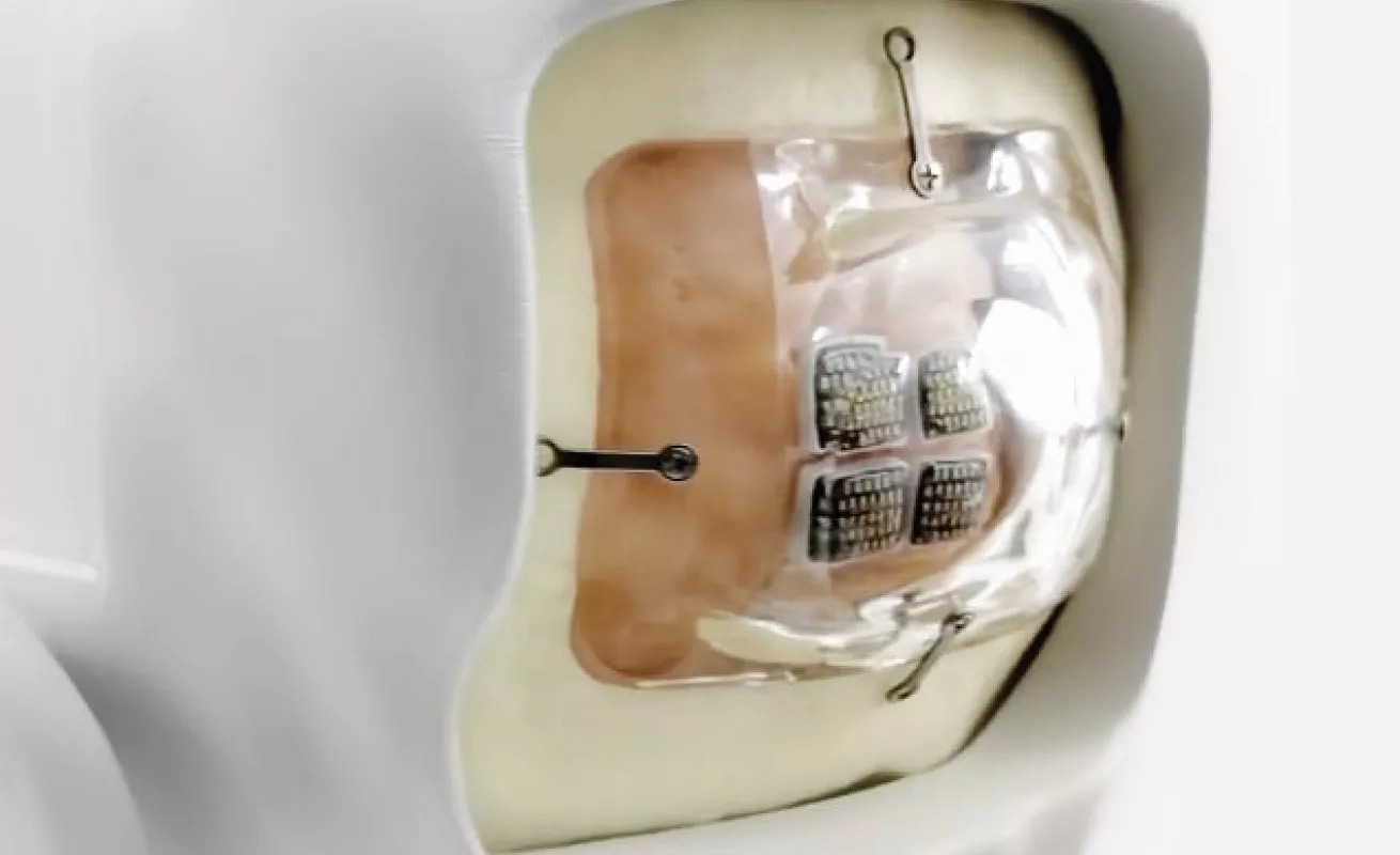 Crean el primer dispositivo para recuperar la visión (Fotos)